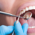 fethiye diş hekimi (4)